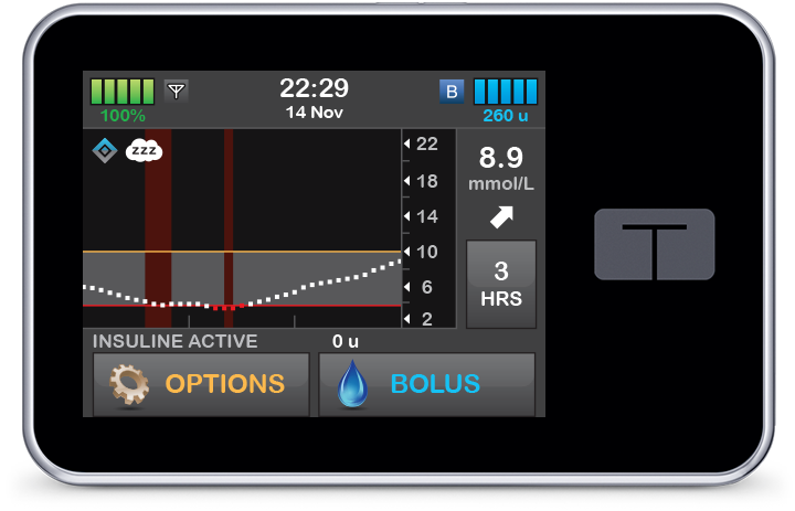 Control-IQ Sleep