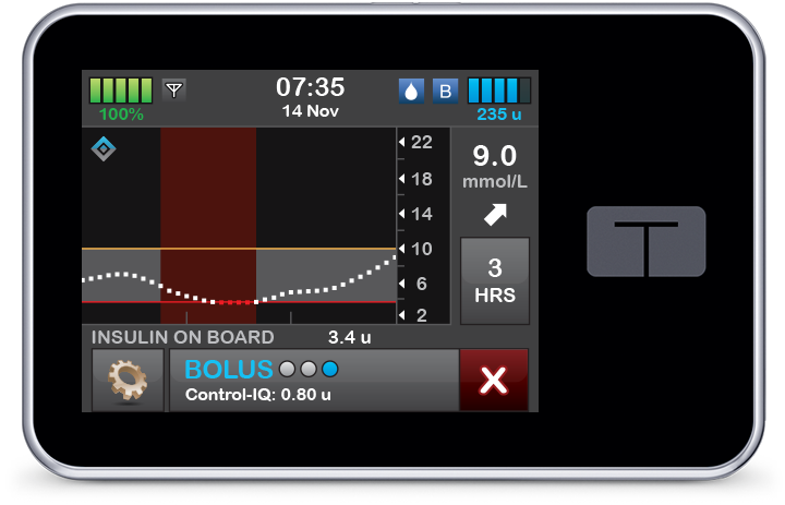 Control-IQ Technology Auto Bolus