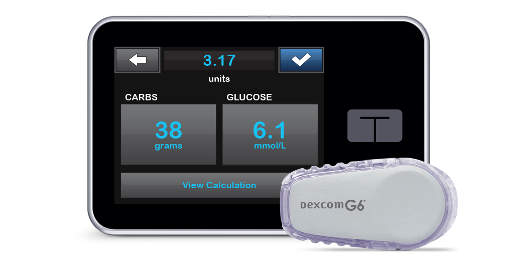 t:slim X2 Insulin Pump with Control-IQ Technology