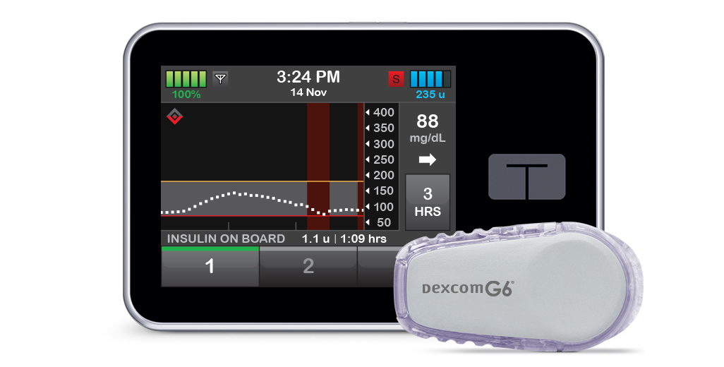 t:slim X2 Insulin Pump with Basal-IQ Technology