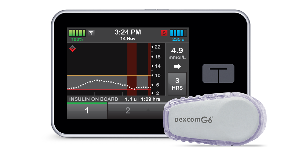 t:slim X2 Insulin Pump with Basal-IQ Technology