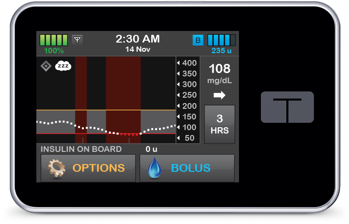 Control-IQ Technology Sleep Activity