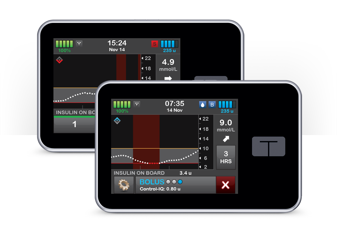 t:slim X2 Insulin Pump