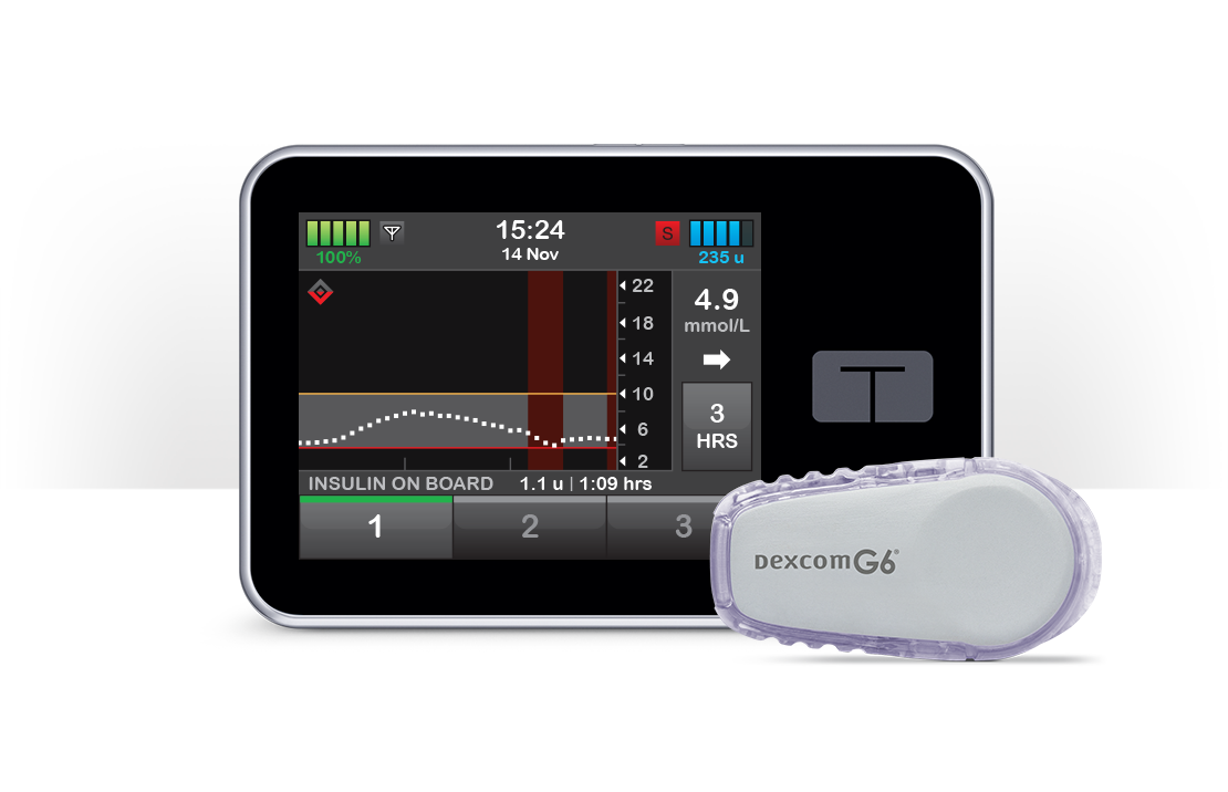 t:slim X2 Insulin Pump with Basal-IQ Technology