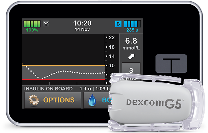 insulin_pump_tslimx2_wbasal-iq_wdexcom_g5_sensor