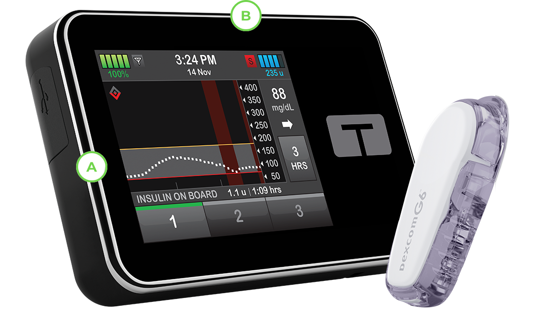 Basal-IQ Technology with Dexcom G6 CGM