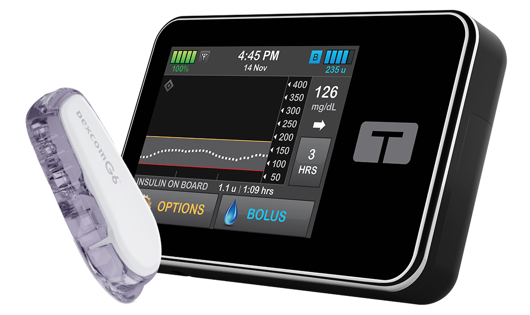 Basal-IQ Technology with Dexcom G6 CGM