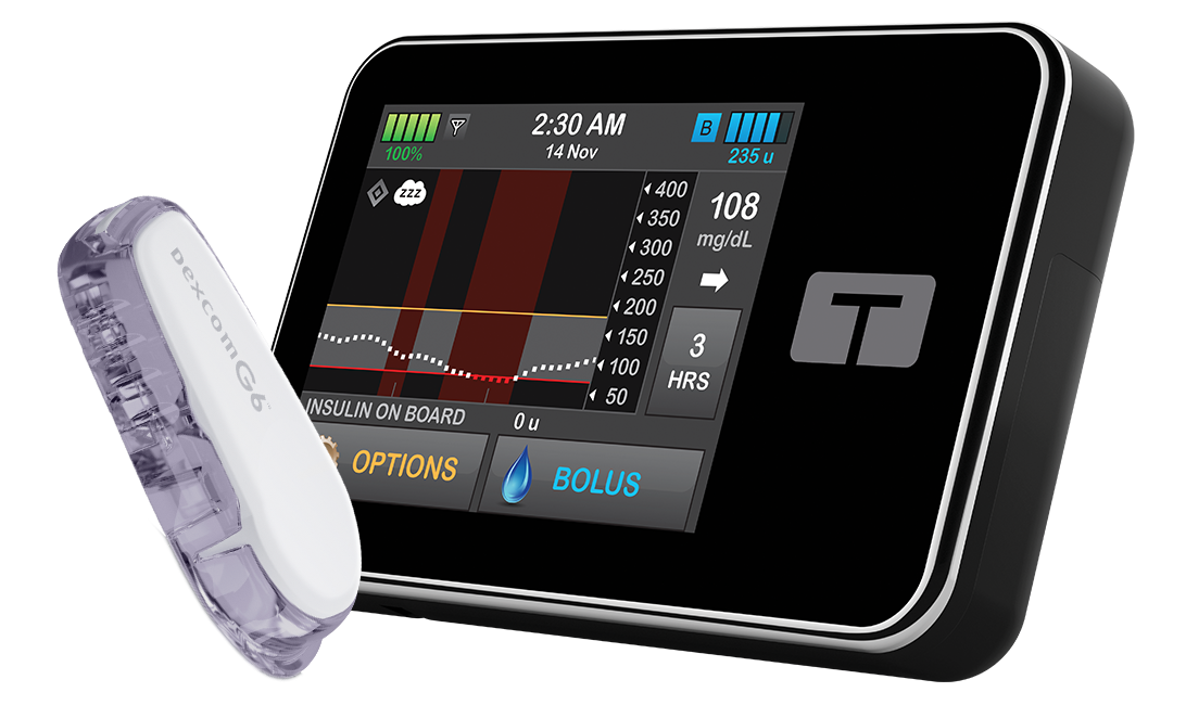 Sleep Activity with Dexcom G6 CGM